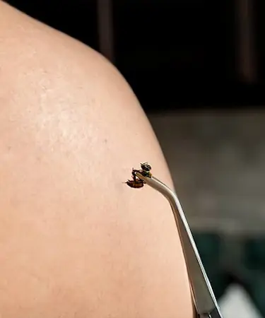 Apiterapeuta Profesional: Terapias con Veneno de Abeja y Productos Apícolas