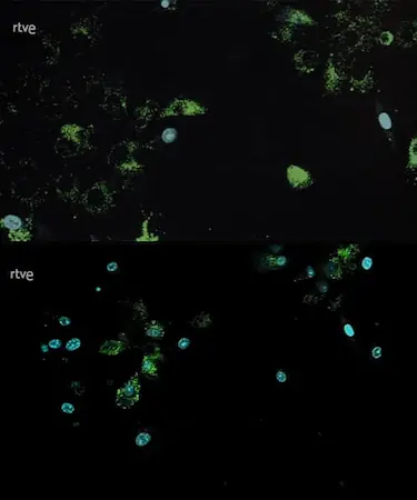 Efecto del veneno de abeja en glóbulos rojos durante la primera exposición
